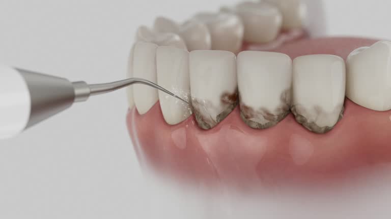Reliable Dental contractor in Carroll County County, IN by Dentist Open Now